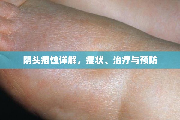 阴头疳蚀详解，症状、治疗与预防
