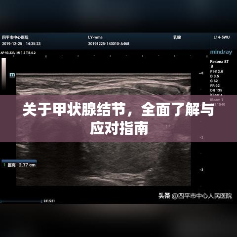 关于甲状腺结节，全面了解与应对指南