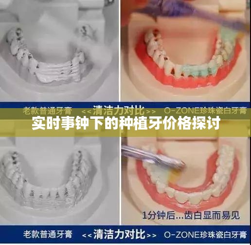 实时事钟下的种植牙价格探讨