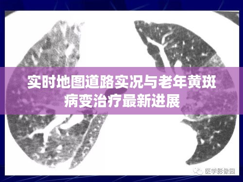 实时地图道路实况与老年黄斑病变治疗最新进展