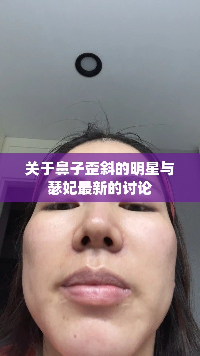 关于鼻子歪斜的明星与瑟妃最新的讨论