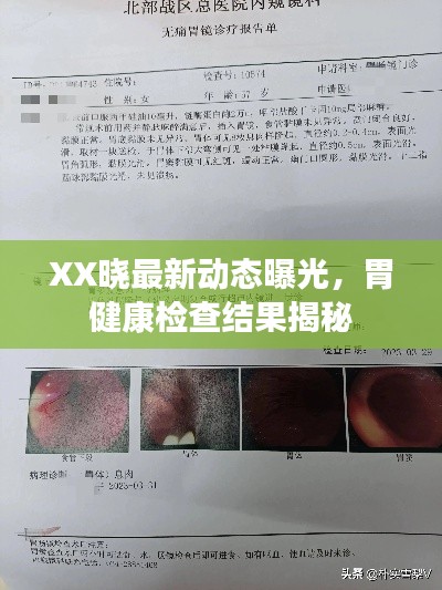 XX晓最新动态曝光，胃健康检查结果揭秘