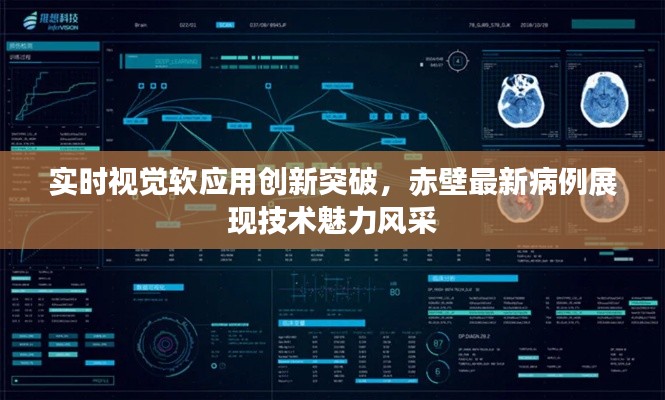 实时视觉软应用创新突破,赤壁最新病例展现技术魅力风采