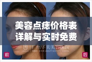 美容点痣价格表详解与实时免费翻译服务