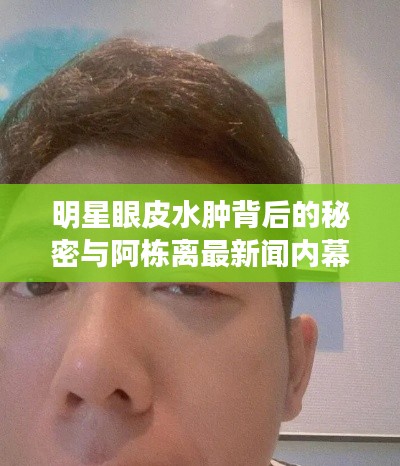 明星眼皮水肿背后的秘密与阿栋离最新闻内幕揭秘